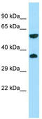 G Protein-Coupled Receptor 22 antibody, TA338156, Origene, Western Blot image 