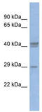CCAAT Enhancer Binding Protein Delta antibody, TA343515, Origene, Western Blot image 