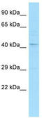 RNA Binding Fox-1 Homolog 1 antibody, TA343881, Origene, Western Blot image 
