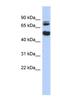 NIM1 Serine/Threonine Protein Kinase antibody, NBP1-56740, Novus Biologicals, Western Blot image 