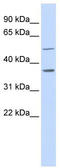 PRG-2 antibody, TA338852, Origene, Western Blot image 