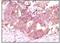 Fibroblast Growth Factor 2 antibody, MA5-15276, Invitrogen Antibodies, Immunohistochemistry paraffin image 