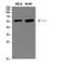 Dopachrome Tautomerase antibody, STJ98956, St John