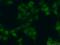 U6 snRNA-associated Sm-like protein LSm4 antibody, 10834-1-AP, Proteintech Group, Immunofluorescence image 