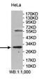 Partner Of NOB1 Homolog antibody, orb78411, Biorbyt, Western Blot image 