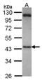 SUFU Negative Regulator Of Hedgehog Signaling antibody, NBP2-20536, Novus Biologicals, Western Blot image 