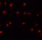 Zinc Finger Protein 281 antibody, GTX31830, GeneTex, Immunocytochemistry image 