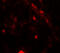 Phosphoinositide-3-Kinase Regulatory Subunit 4 antibody, 7949, ProSci Inc, Immunofluorescence image 