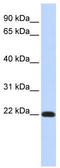 FXYD Domain Containing Ion Transport Regulator 5 antibody, TA338570, Origene, Western Blot image 