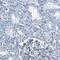 Uroplakin-3a antibody, HPA018407, Atlas Antibodies, Immunohistochemistry frozen image 