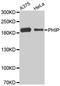 Pleckstrin Homology Domain Interacting Protein antibody, MBS129062, MyBioSource, Western Blot image 
