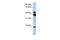 Serine/Threonine Kinase 38 antibody, GTX46199, GeneTex, Western Blot image 