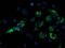 NADH:Ubiquinone Oxidoreductase Subunit A7 antibody, TA502639, Origene, Immunofluorescence image 