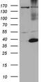 Heat Shock Transcription Factor 2 Binding Protein antibody, M14085, Boster Biological Technology, Western Blot image 