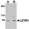 Leucine Zipper Like Transcription Regulator 1 antibody, TA306929, Origene, Western Blot image 