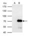Protein Arginine Methyltransferase 3 antibody, GTX116478, GeneTex, Immunoprecipitation image 