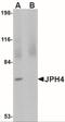 Junctophilin 4 antibody, NBP2-41094, Novus Biologicals, Western Blot image 