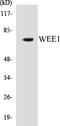 WEE1 G2 Checkpoint Kinase antibody, EKC1599, Boster Biological Technology, Western Blot image 