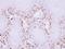 MAGE Family Member A11 antibody, LS-C186156, Lifespan Biosciences, Immunohistochemistry paraffin image 