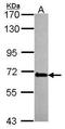 Probable ATP-dependent RNA helicase DDX56 antibody, TA309015, Origene, Western Blot image 