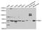 PMS1 Homolog 1, Mismatch Repair System Component antibody, orb48494, Biorbyt, Western Blot image 