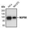 Nuclear pore complex protein Nup98-Nup96 antibody, PA5-17406, Invitrogen Antibodies, Western Blot image 