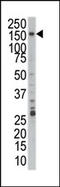 Pre-MRNA Processing Factor 4B antibody, AP14190PU-N, Origene, Western Blot image 