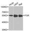 FGR Proto-Oncogene, Src Family Tyrosine Kinase antibody, A01674, Boster Biological Technology, Western Blot image 