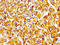 Enoyl-CoA Delta Isomerase 2 antibody, LS-C671746, Lifespan Biosciences, Immunohistochemistry paraffin image 