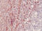 Nitrotyrosine antibody, AM26352PU-N, Origene, Immunohistochemistry frozen image 
