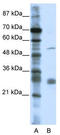 Leucine Rich Repeat Containing 14 antibody, TA337304, Origene, Western Blot image 