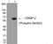 Dihydropyrimidinase Like 2 antibody, GTX55382, GeneTex, Western Blot image 
