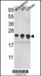 PRDX2 antibody, 61-602, ProSci, Western Blot image 