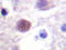 Protein Kinase, DNA-Activated, Catalytic Subunit antibody, AP20223PU-N, Origene, Immunohistochemistry paraffin image 
