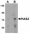 Protein Inhibitor Of Activated STAT 2 antibody, LS-C108717, Lifespan Biosciences, Western Blot image 