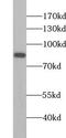 Zinc Finger Protein 611 antibody, FNab09720, FineTest, Western Blot image 