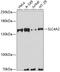 Solute Carrier Family 4 Member 2 antibody, A04019, Boster Biological Technology, Western Blot image 