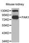 P21 (RAC1) Activated Kinase 1 antibody, STJ24888, St John