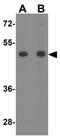 Equilibrative nucleoside transporter 3 antibody, GTX32151, GeneTex, Western Blot image 