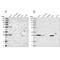 Biphenyl Hydrolase Like antibody, NBP2-38328, Novus Biologicals, Western Blot image 