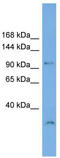 DENN domain-containing protein 1A antibody, TA344747, Origene, Western Blot image 