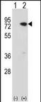 Methyl-CpG Binding Protein 2 antibody, PA5-49550, Invitrogen Antibodies, Western Blot image 