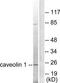 Caveolin 1 antibody, TA326097, Origene, Western Blot image 