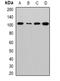 Exocyst complex component 2 antibody, orb341455, Biorbyt, Western Blot image 