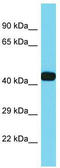 Divergent Protein Kinase Domain 2B antibody, TA331575, Origene, Western Blot image 