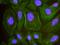 Nuclear Receptor Corepressor 1 antibody, A301-145A, Bethyl Labs, Proximity Ligation Assay image 