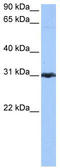 Peroxiredoxin 3 antibody, TA340179, Origene, Western Blot image 
