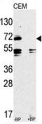 Toll Like Receptor 2 antibody, AP11527PU-N, Origene, Western Blot image 