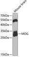 Myelin Oligodendrocyte Glycoprotein antibody, GTX54371, GeneTex, Western Blot image 
