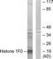 Histone H1.0 antibody, TA313993, Origene, Western Blot image 